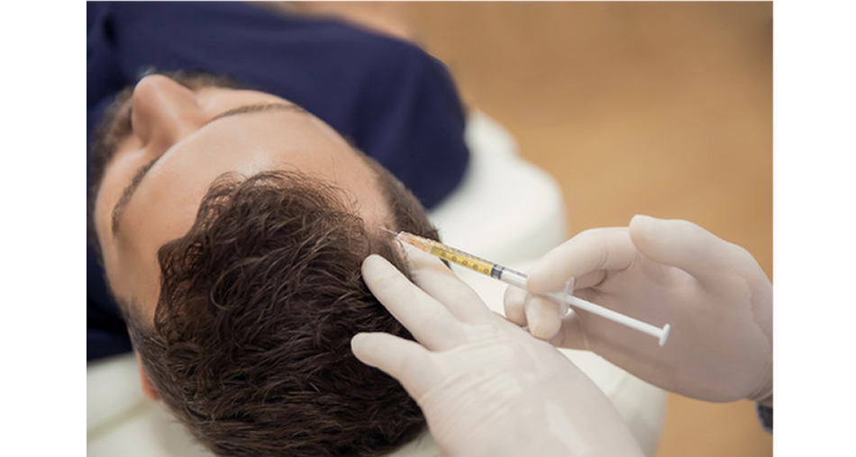 Plasma Rico en Plaquetas (PRP)