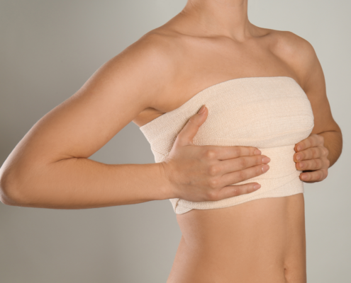 Marcación de abdomen