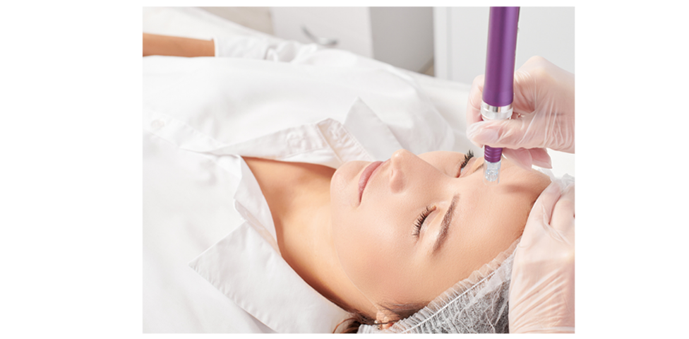 Microneedling